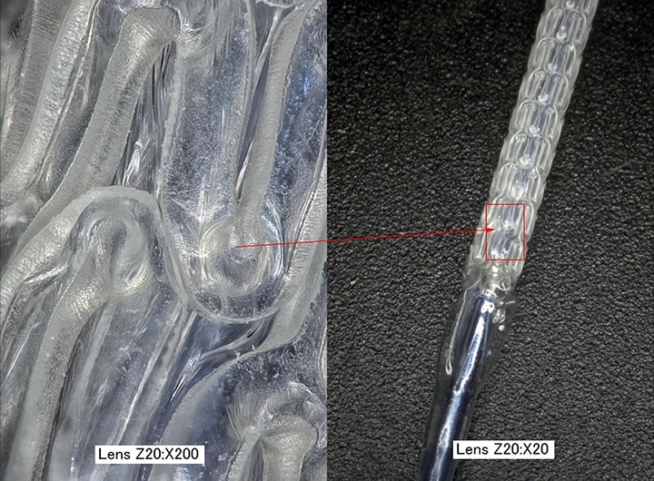 Magnified images of a bioabsorbable stent (left: 200x/right: 20x)